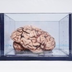 The World’s Most Famous Brain
