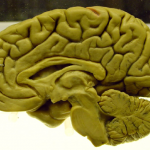 The Brain – Sagittal Section