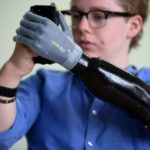 British Teenager Gets a Robotic Hand