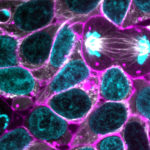 Gene Edited, Human induced Pluripotent Stem Cells (iPSCs)